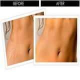 Derma Roller for Skin Care-Beauty-Prime4Choice.com-Prime4Choice.com
