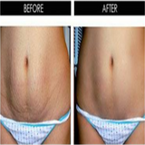 Derma Roller for Skin Care-Beauty-Prime4Choice.com-Prime4Choice.com